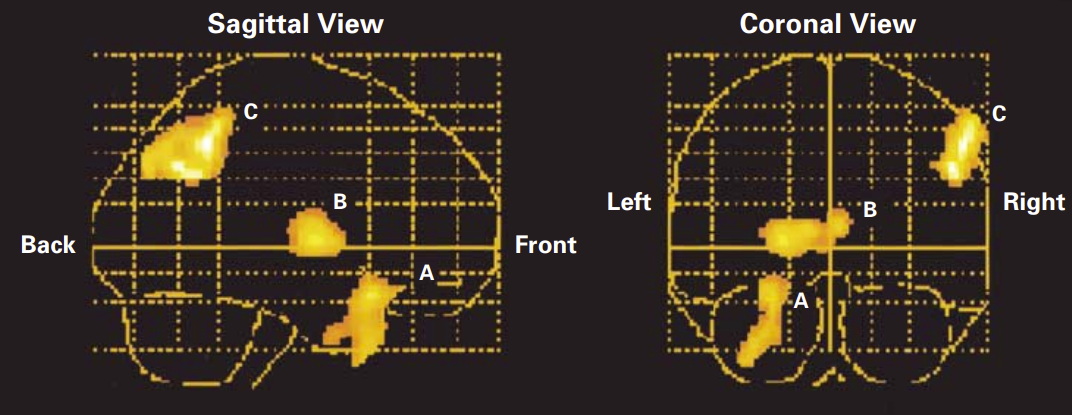 科学家在大脑深处发现抑郁开关