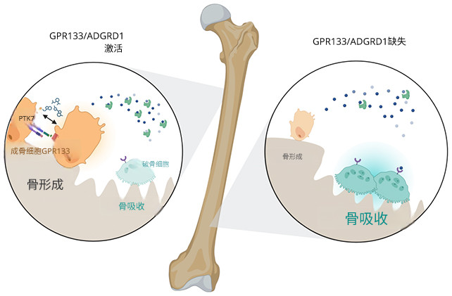 骨质疏松或迎来逆转：科学家发现强化骨骼关键开关