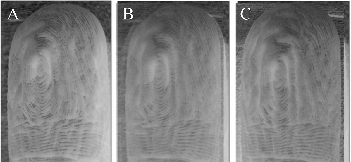 手指泡水后每次都会以同样的方式起皱