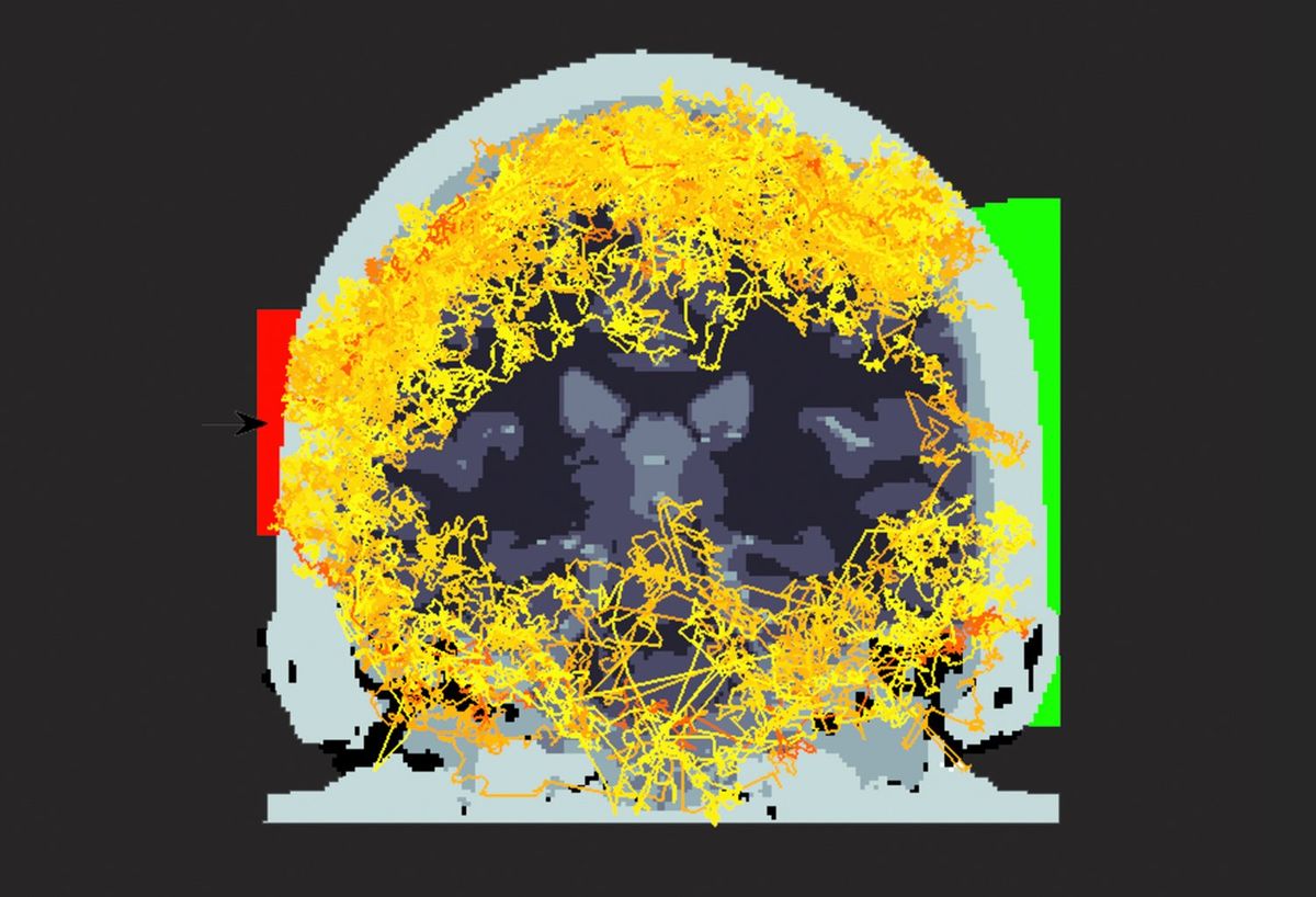 科学家用激光穿透人脑，开启廉价脑成像新时代