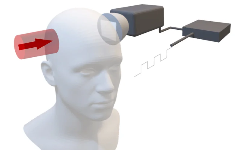 科学家用激光穿透人脑，开启廉价脑成像新时代