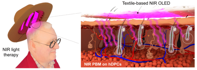 韩国科学家研发出能抑制92%脱发标志物的发光帽子