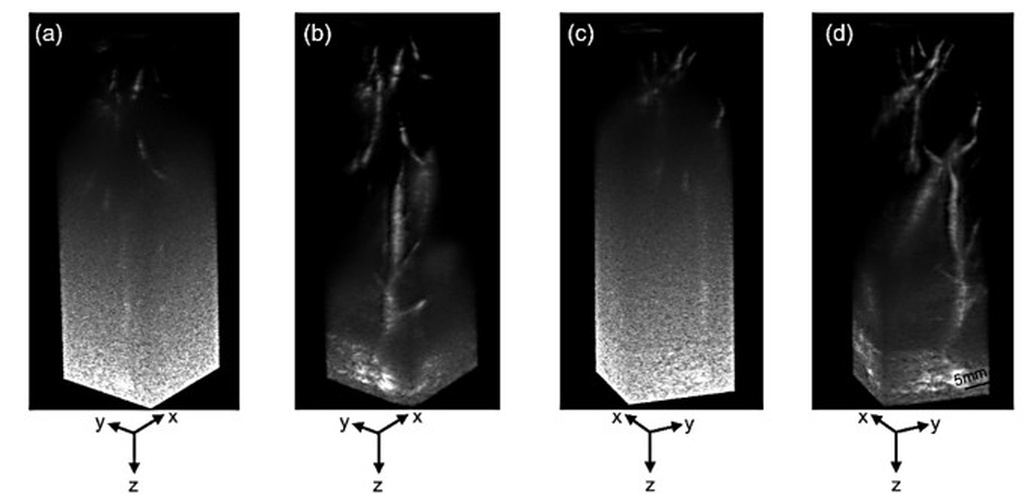 全新超声技术，无需造影剂也能看清皮下深处血管