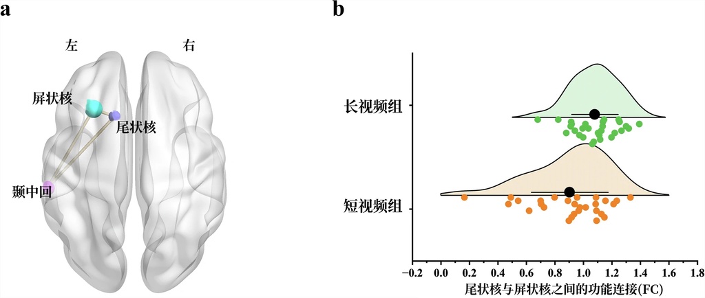 为什么刷短视频时真的学不进去：大脑同步实验揭秘