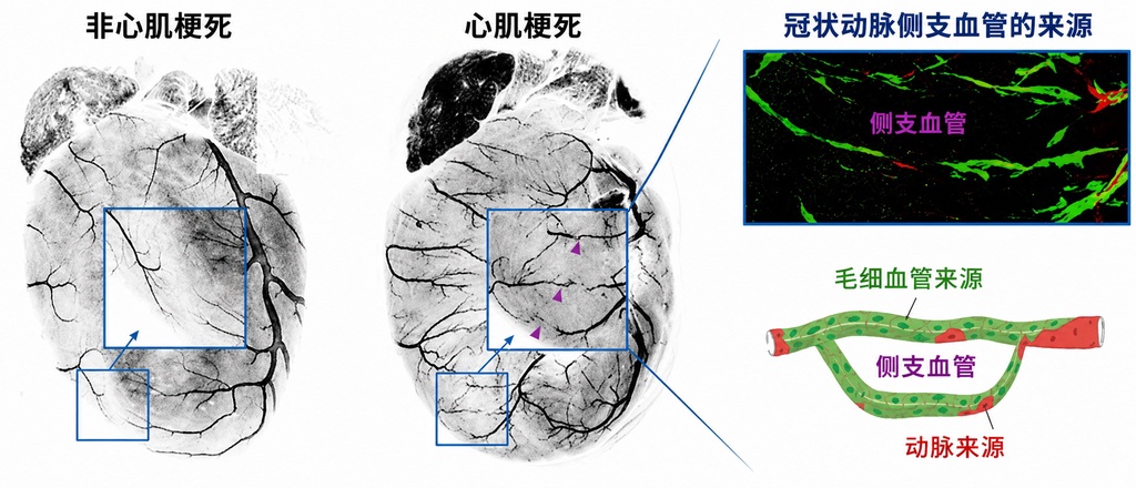 心脏自救的秘密:毛细血管会变身新动脉