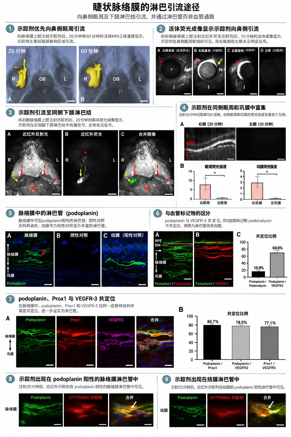 科学家发现眼睛深处的淋巴清理系统