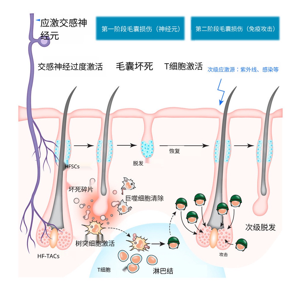 为什么压力会让你头秃