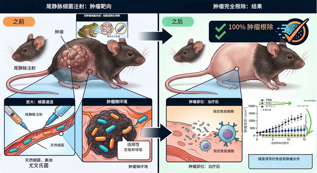 单次注射消灭100%肿瘤：这种青蛙肠道细菌可能改写癌症治疗规则