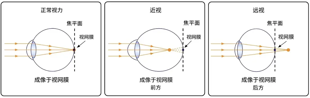 显示器会使眼睛疲劳，新技术可以让屏幕看起来更远