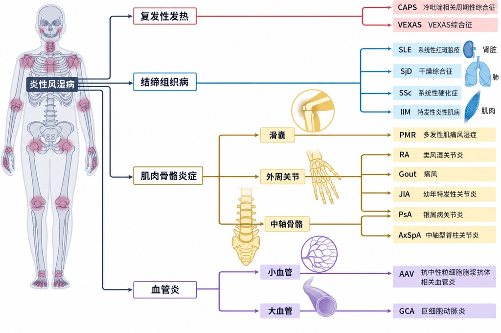 风湿病为何反反复复?分子图谱揭开底层逻辑
