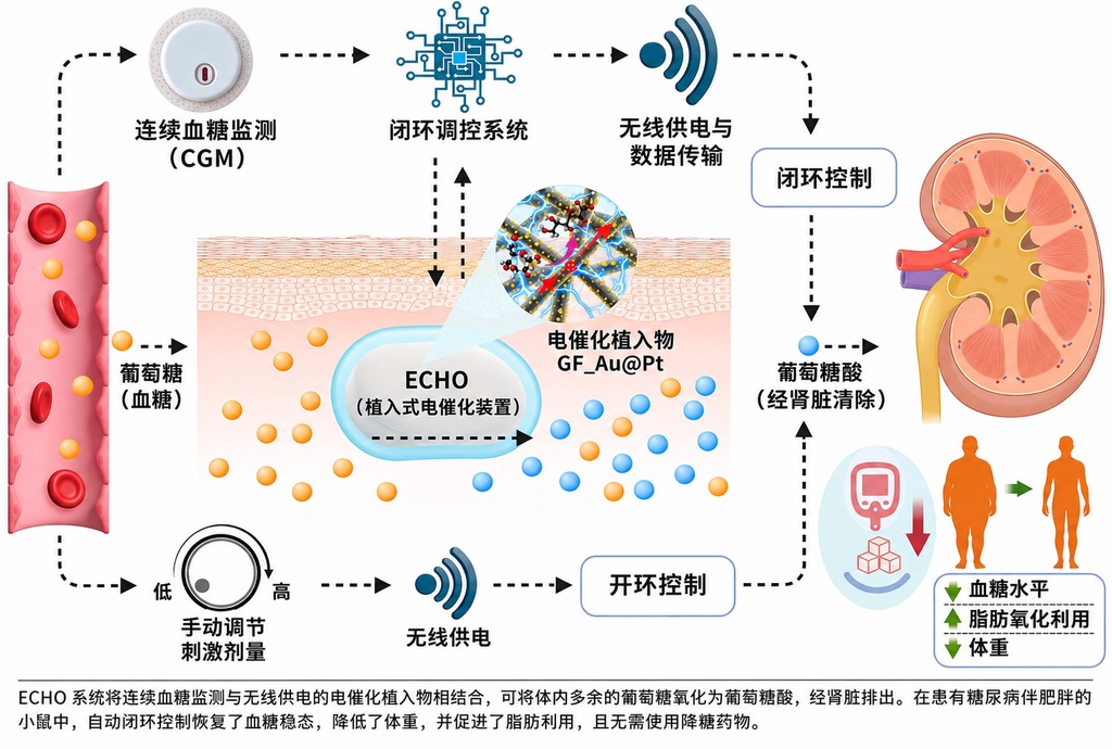 糖尿病治疗新思路：皮下植入装置，自动清除多余葡萄糖