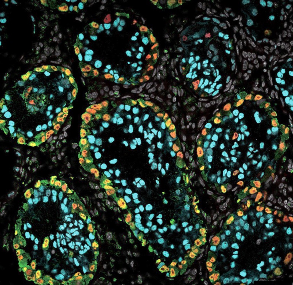 实验室培育人类精子：科学家离生育突破又近了一步