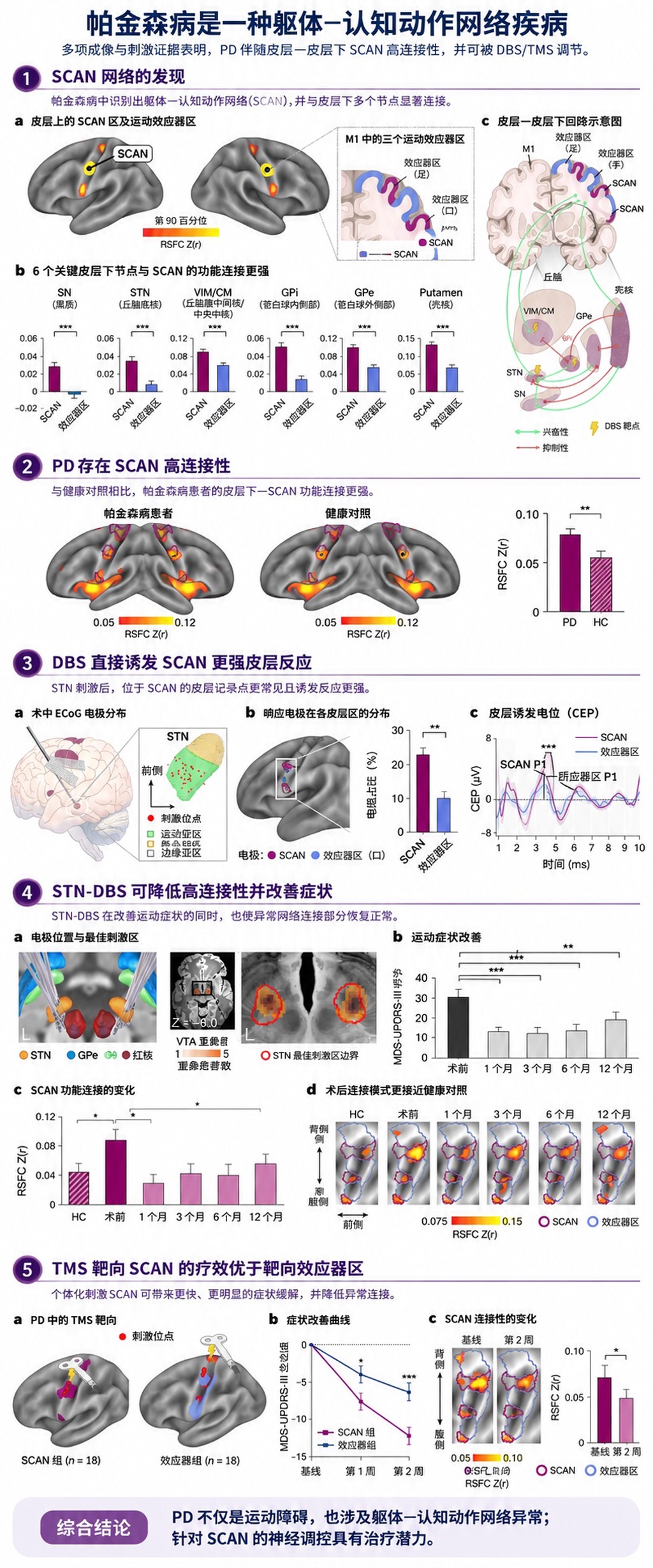 帕金森病不只是运动障碍,科学家发现关键脑网络