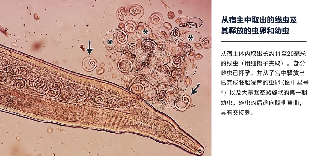 韩国老人眼痛2个月,医生从眼球取出11条蠕虫