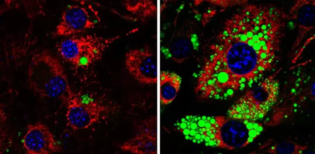 科学家首次发现控制脂肪细胞长大或缩小的”开关蛋白”