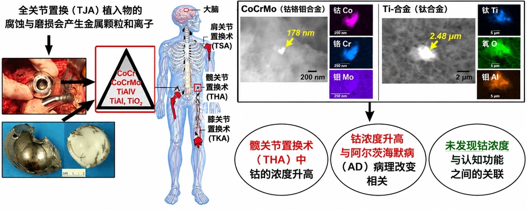 人工关节磨损颗粒可能穿透血脑屏障进入大脑