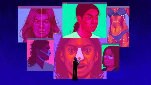 坦白局：好莱坞明星开始承认动脸，甚至公布手术细节